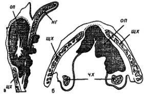 Схема распространения рака преддверия гортани